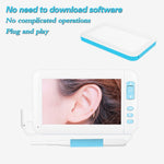 C01 Endoscope visuel pour oreille écran 4.3 pouces HD1080P avec 6 LED, Diamètre : 3.9mm, C01 3.9mm