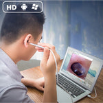 Endoscope visuel HD 1MP pour oreille, nez, dents avec 6 LED, diamètre de lentille : 4,3 mm