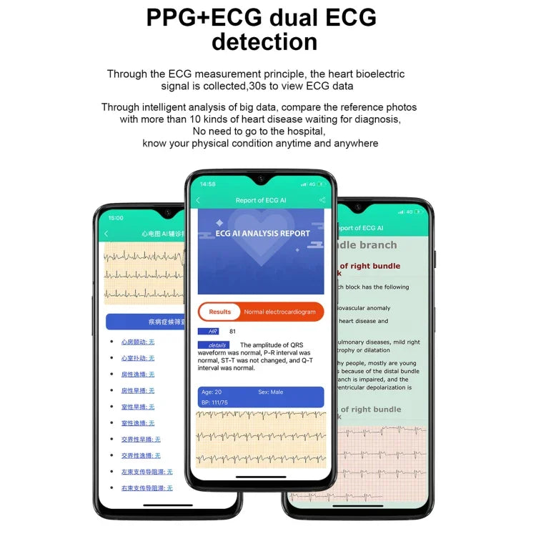 Montre connectée E86 avec écran couleur TFT 1,7 pouce, étanche IP68, compatible avec la surveillance de l'oxygène sanguin et de la température corporelle, et proposant des diagnostics médicaux par IA. Bracelet en cuir.