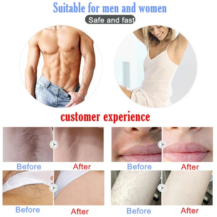 Appareil d'épilation laser IPL indolore beauté pour usage domestique, hommes et femmes