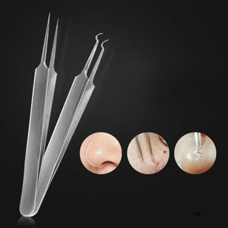 5 PCS / Set Meilleur Outil Extracteur de Points Noirs Aiguille à Acné Pince à Boutons