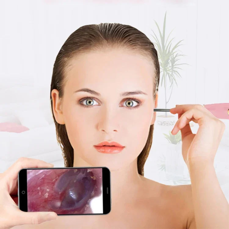 Caméra endoscopique WiFi A1 720P pour nettoyage des oreilles, outil sans fil sûr, cuillère visuelle pour oreille, diamètre : 3,9 mm, A2