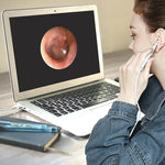 i95 Endoscope USB 3 en 1 pour oreilles, caméra d'inspection HD 0.3MP, curette visuelle pour téléphones OTG Android, PC et MacBook, câble de 1,75 m, 3 en 1 blanc 0.3MP