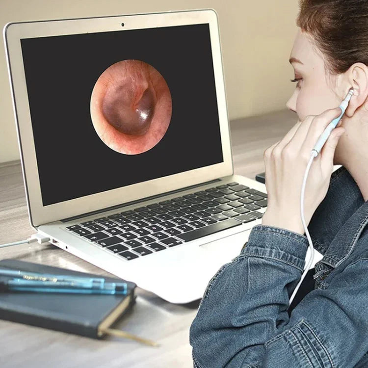 i95 Endoscope USB 3 en 1 pour oreilles, caméra d'inspection HD 0.3MP, curette visuelle pour téléphones OTG Android, PC et MacBook, câble de 1,75 m, 3 en 1 blanc 0.3MP