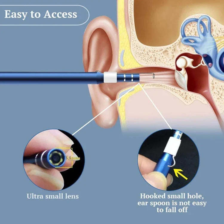 i95 Endoscope USB 3 en 1 pour oreilles, caméra d'inspection HD 0.3MP, curette visuelle pour téléphones OTG Android, PC et MacBook, câble de 1,75 m, 3 en 1 blanc 0.3MP