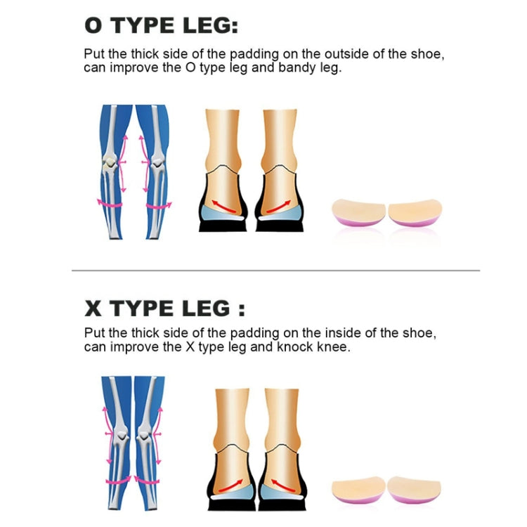 Version améliorée de semelle orthopédique correctrice pour jambes en O/X pour hommes et femmes, coussinet de talon correcteur intérieur/extérieur pour huit pieds