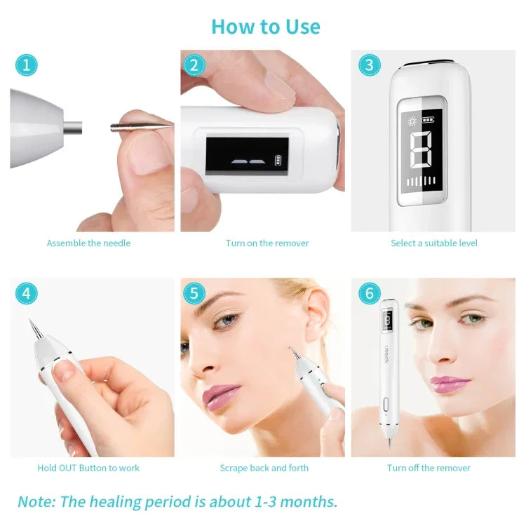 Xpreen XPRE061 Éliminateur professionnel de taches sombres, taches de rousseur, tatouages, verrues et grains de beauté rechargeable, avec écran LED et projecteur