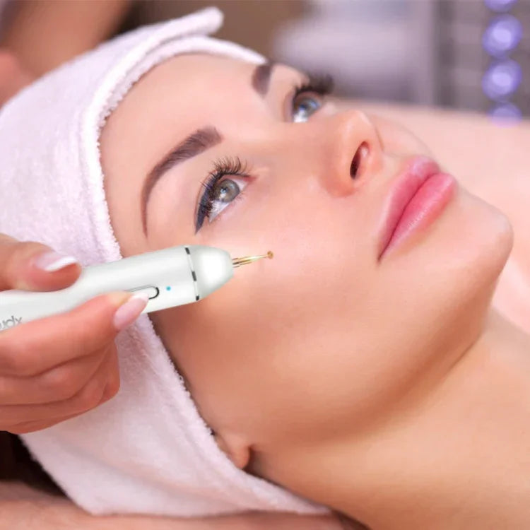 Xpreen XPRE061 Éliminateur professionnel de taches sombres, taches de rousseur, tatouages, verrues et grains de beauté rechargeable, avec écran LED et projecteur
