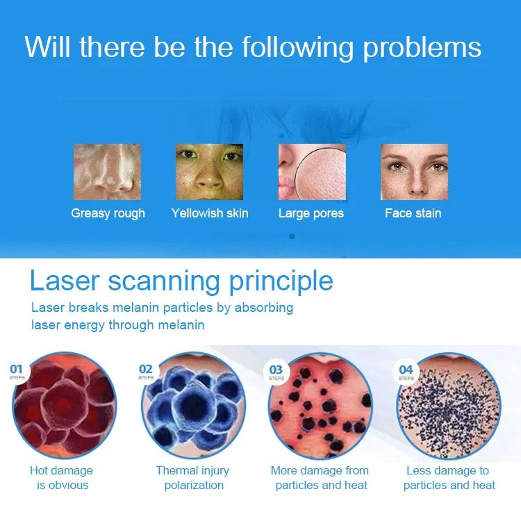 Stylo de soin beauté laser plasma portable à picoseconde (élimination tatouage, tache de rousseur, grain de beauté), lumière bleue USB / lumière rouge USB