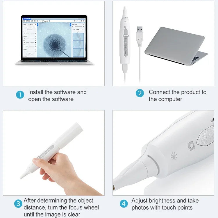 Endoscope électronique numérique sans fil Supereyes Y008P pour oreilles, nez et bouche, Y008P