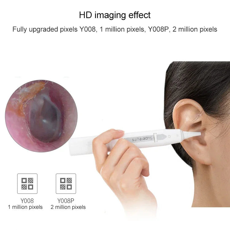 Endoscope électronique numérique sans fil Supereyes Y008P pour oreilles, nez et bouche, Y008P