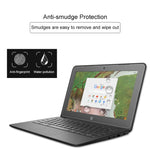 Film de protection universel en verre trempé HD pour ordinateur portable de 11,6 pouces, 11,6 pouces