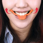 Mini outil d'orthèse de sourire Smile Maker, livraison de couleur aléatoire, outil d'orthèse de sourire
