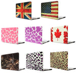 Coque de protection rigide givrée pour Macbook Pro 15,4 pouces, S-MAC-0024A, S-MAC-0024B, S-MAC-0024C, S-MAC-0024D, S-MAC-0024E, S-MAC-0024F, S-MAC-0024G, S-MAC-0024H