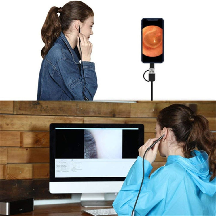 Endoscope numérique d'inspection USB HD 3 en 1 type otoscope oreille cire d'oreille