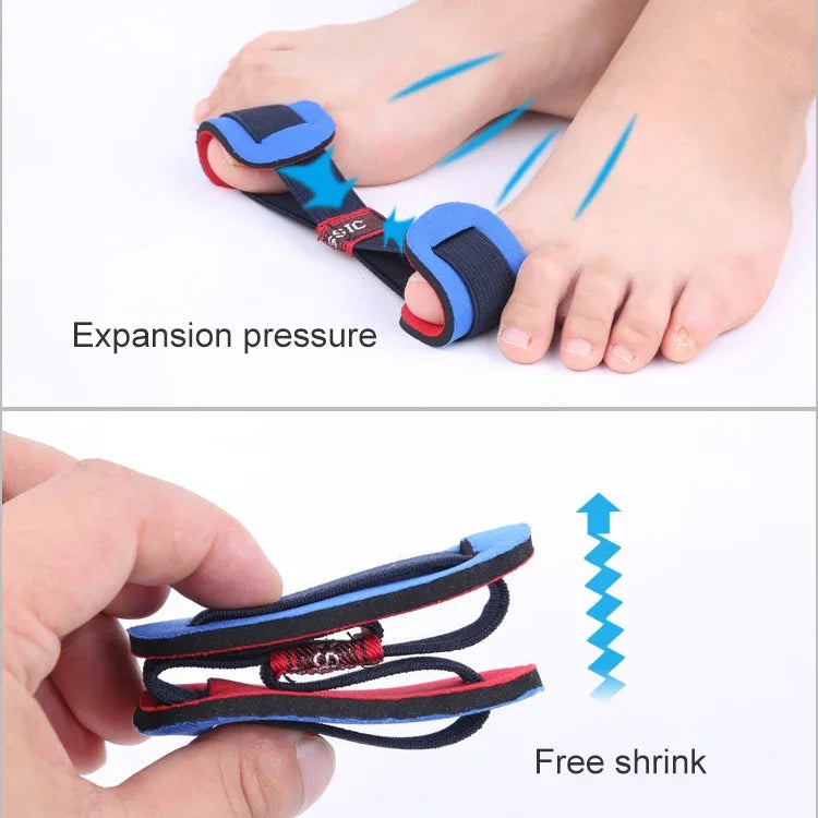 Outil professionnel de soin des pieds Correcteur d'oignon Protecteur d'oignon Redresseur d'hallux valgus Écarteur d'orteils Pédicure
