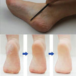 Outil de Soin des Pieds et des Ongles pour Pédicure, Manucure, Nettoyeur d'Ongles, Soin des Cuticules, Rabot de Peau Morte
