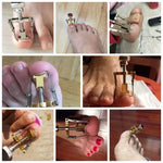 Ongles incarnés Pédicure Soins des pieds Outils correcteurs d'oignon pour orteils