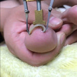 Ongles incarnés Pédicure Soins des pieds Outils correcteurs d'oignon pour orteils