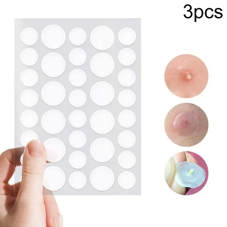 3 pièces ensemble d'outils contre l'acné, traitement des cicatrices d'acné, autocollants anti-boutons
