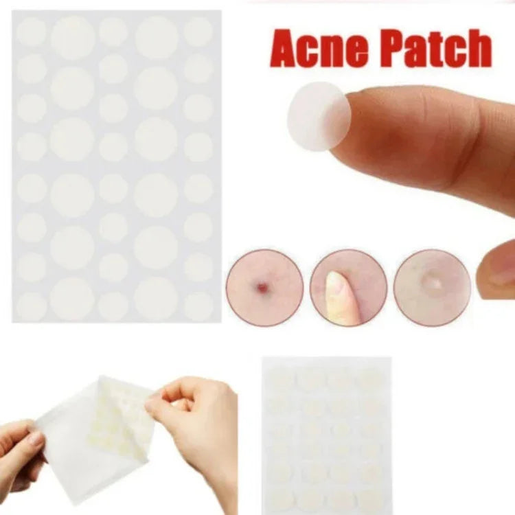 3 pièces ensemble d'outils contre l'acné, traitement des cicatrices d'acné, autocollants anti-boutons