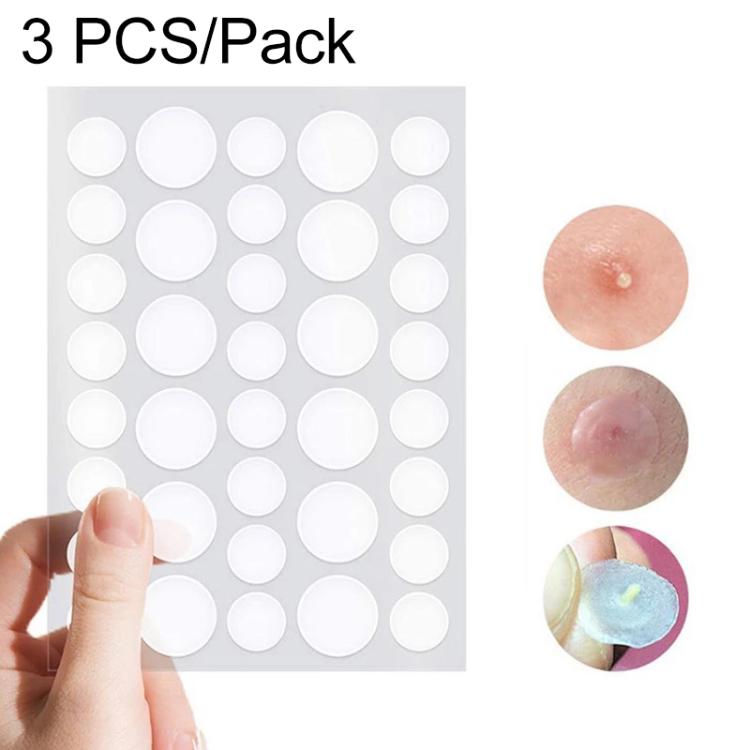 3 pièces ensemble d'outils contre l'acné, traitement des cicatrices d'acné, autocollants anti-boutons