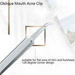5 pièces/lot d'aiguilles anti-acné en acier inoxydable, pince anti-acné, outil pour points noirs, 5 en 1