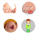Orthèse d'ongle 12 en 1 avec ongles incarnés