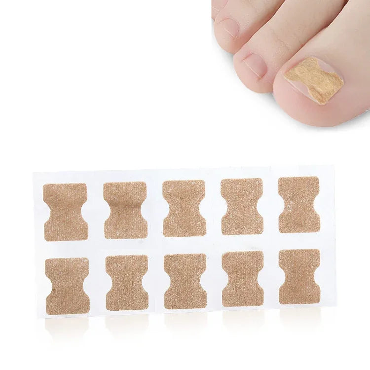 10 PCS Correcteur Orthopédique D'ongles Sans Colle, Bâtonnet Rainure Ongle Orteil Incrustation Correcteur, Fond Transparent, Fond Blanc, Fond Bleu