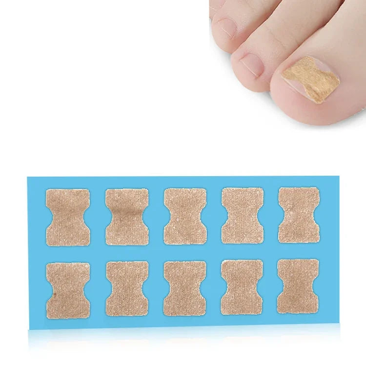 10 PCS Correcteur Orthopédique D'ongles Sans Colle, Bâtonnet Rainure Ongle Orteil Incrustation Correcteur, Fond Transparent, Fond Blanc, Fond Bleu