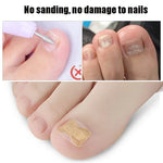 10 PCS Correcteur Orthopédique D'ongles Sans Colle, Bâtonnet Rainure Ongle Orteil Incrustation Correcteur, Fond Transparent, Fond Blanc, Fond Bleu