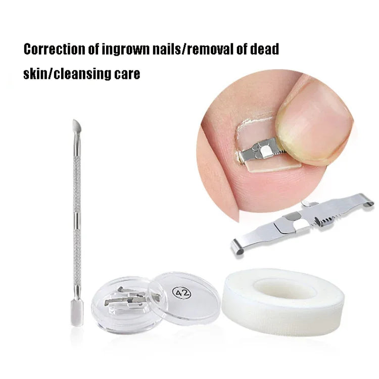 Correcteur d'ongles incarnés orthopédiques à boucle, boucle d'ongle positive n° 36, boucle d'ongle positive n° 38, boucle d'ongle positive n° 40, boucle d'ongle positive n° 42, boucle d'ongle positive n° 44, kit n° 36, kit n° 38, kit n° 40, kit n° 42