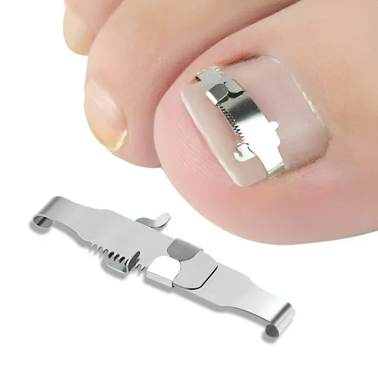 Correcteur d'ongles incarnés orthopédiques à boucle, boucle d'ongle positive n° 36, boucle d'ongle positive n° 38, boucle d'ongle positive n° 40, boucle d'ongle positive n° 42, boucle d'ongle positive n° 44, kit n° 36, kit n° 38, kit n° 40, kit n° 42