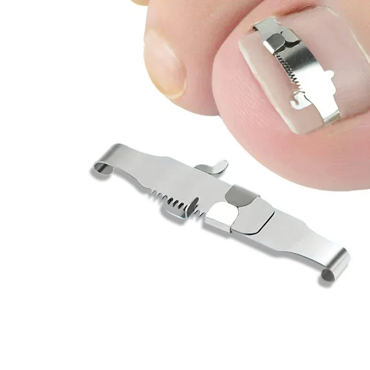 Correcteur d'ongles incarnés orthopédiques à boucle, boucle d'ongle positive n° 36, boucle d'ongle positive n° 38, boucle d'ongle positive n° 40, boucle d'ongle positive n° 42, boucle d'ongle positive n° 44, kit n° 36, kit n° 38, kit n° 40, kit n° 42