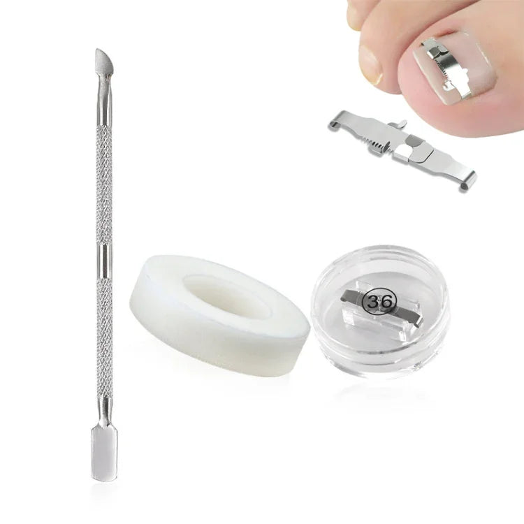 Correcteur d'ongles incarnés orthopédiques à boucle, boucle d'ongle positive n° 36, boucle d'ongle positive n° 38, boucle d'ongle positive n° 40, boucle d'ongle positive n° 42, boucle d'ongle positive n° 44, kit n° 36, kit n° 38, kit n° 40, kit n° 42
