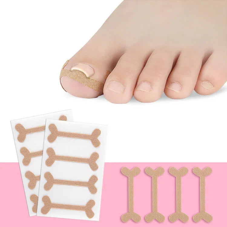 10 jeux de bandes de correction pour ongles incarnés Bande de sillon d'ongle d'orteil