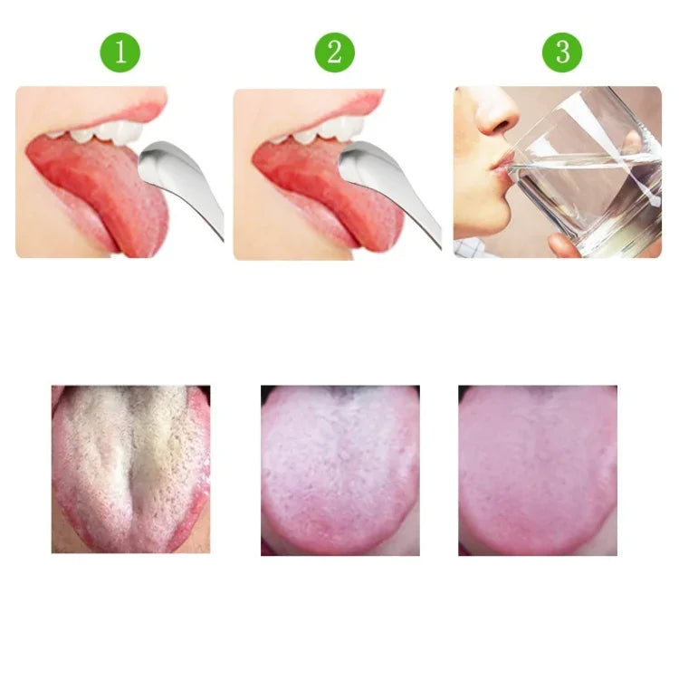 Grattoir à Langue en Acier Inoxydable pour Mauvaise Haleine + Ensemble de Deux Pièces (Or Rose), Grattoir à Langue + Ensemble de Deux Pièces (Argent), Grattoir à Langue + Ensemble de Deux Pièces (Or Rose)