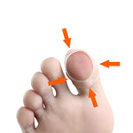 Ongles incarnés : empêche les ongles de s'enfoncer dans la chair, correction d'ongles, taille unique