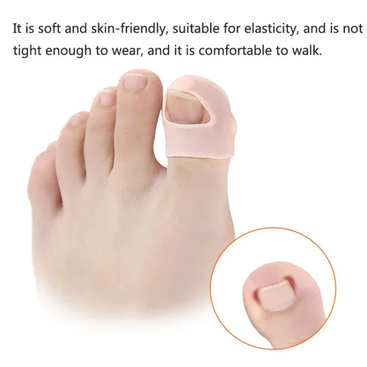 Ongles incarnés : empêche les ongles de s'enfoncer dans la chair, correction d'ongles, taille unique