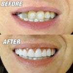 Outil de beauté faux dents sourire instantané, couverture de dent flexible confortable