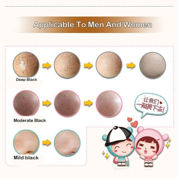3 masques pour le nez de porc pour éliminer les points noirs, l'acné, le kit de soin en 3 étapes, bleu, rouge